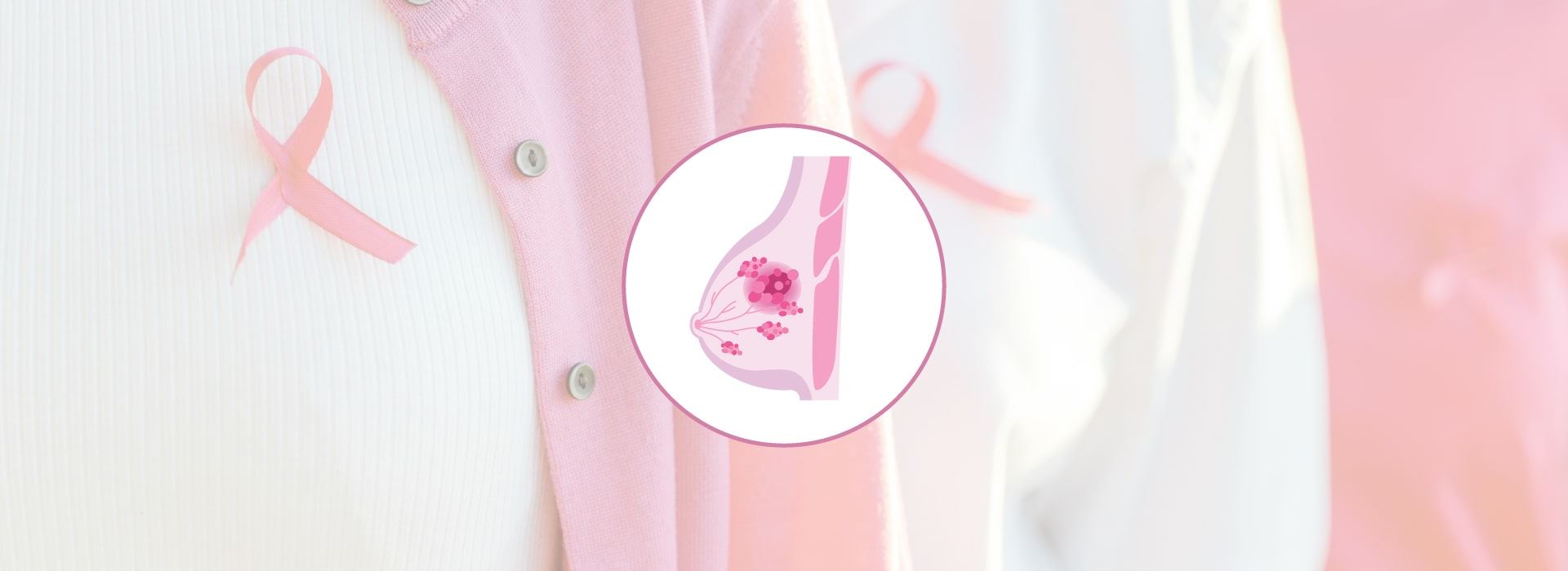 Breast Cancer Program