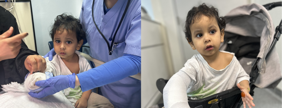JHAH plastic surgeon helps toddler regain use of little finger with first known tendon surgery of its kind